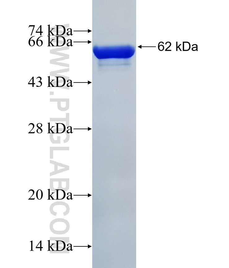 CBR3 fusion protein Ag8039 SDS-PAGE