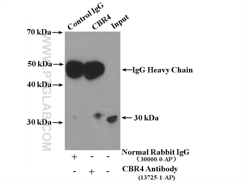 Immunoprecipitation (IP) experiment of HepG2 cells using CBR4 Polyclonal antibody (13725-1-AP)