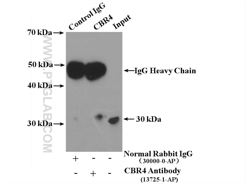 IP experiment of HepG2 using 13725-1-AP