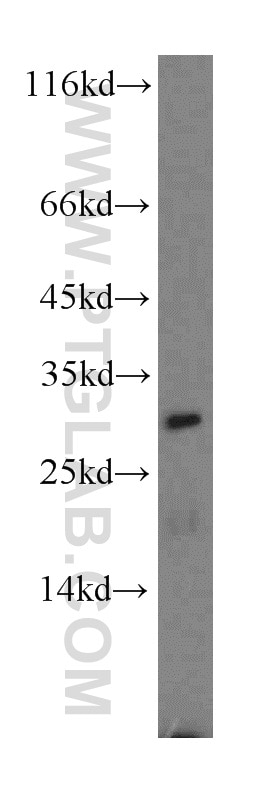 Western Blot (WB) analysis of HepG2 cells using CBR4 Polyclonal antibody (13725-1-AP)