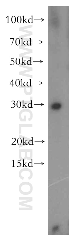 Western Blot (WB) analysis of BxPC-3 cells using CBR4 Polyclonal antibody (13725-1-AP)