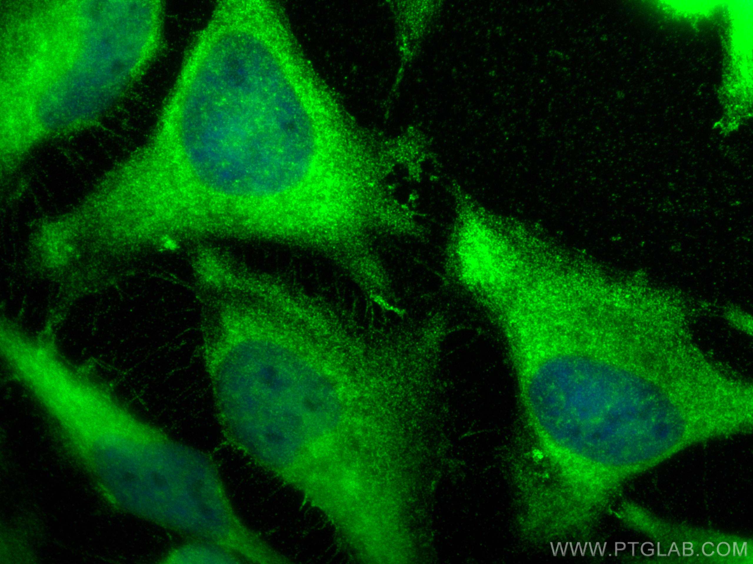 Immunofluorescence (IF) / fluorescent staining of HeLa cells using CBS Polyclonal antibody (14787-1-AP)