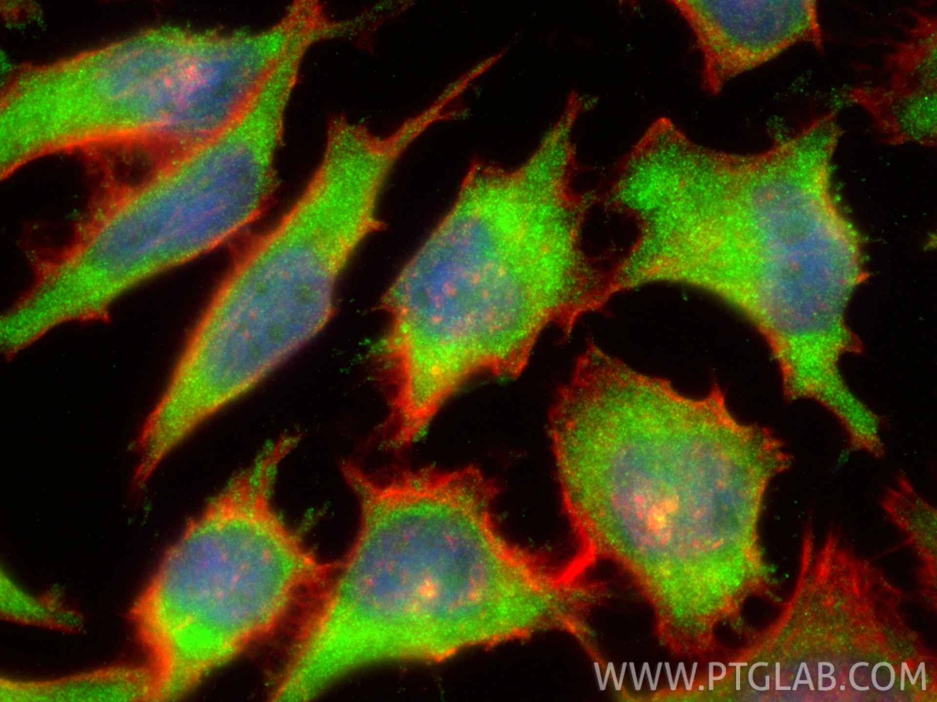 IF Staining of HeLa using 14787-1-AP Immunofluorescence (IF) / fluorescent staining of HeLa cells using CBS Polyclonal antibody (14787-1-AP)