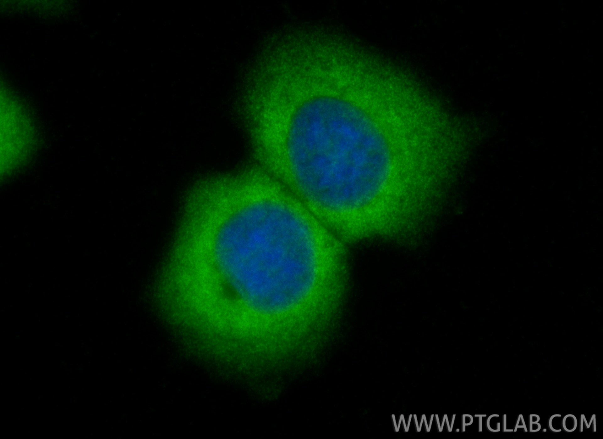 IF Staining of MCF-7 using 14787-1-AP Immunofluorescence (IF) / fluorescent staining of MCF-7 cells using CBS Polyclonal antibody (14787-1-AP)