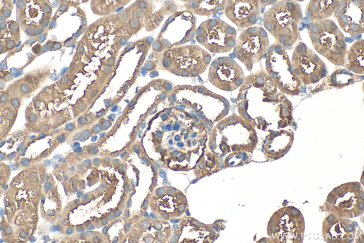 Immunohistochemistry (IHC) staining of mouse kidney tissue using CBS Polyclonal antibody (14787-1-AP)