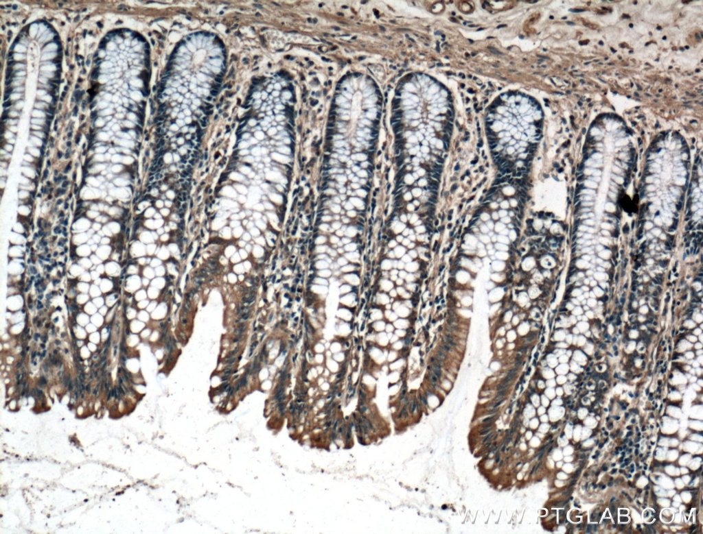 Immunohistochemistry (IHC) staining of human colon tissue using CBS Polyclonal antibody (14787-1-AP)