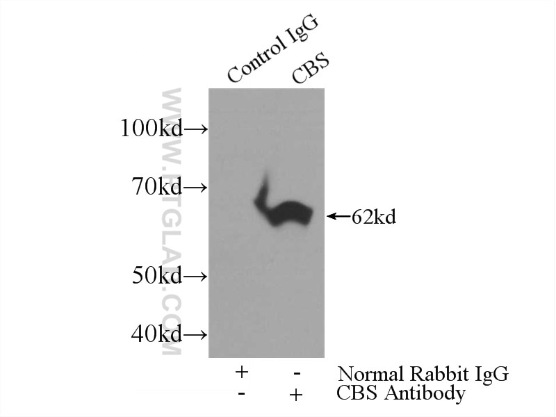 Immunoprecipitation (IP) experiment of mouse kidney tissue using CBS Polyclonal antibody (14787-1-AP)