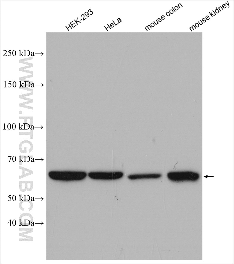 Western Blot (WB) analysis of various lysates using CBS Polyclonal antibody (14787-1-AP)