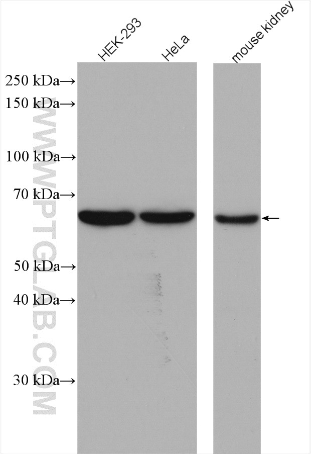 Western Blot (WB) analysis of various lysates using CBS Polyclonal antibody (14787-1-AP)