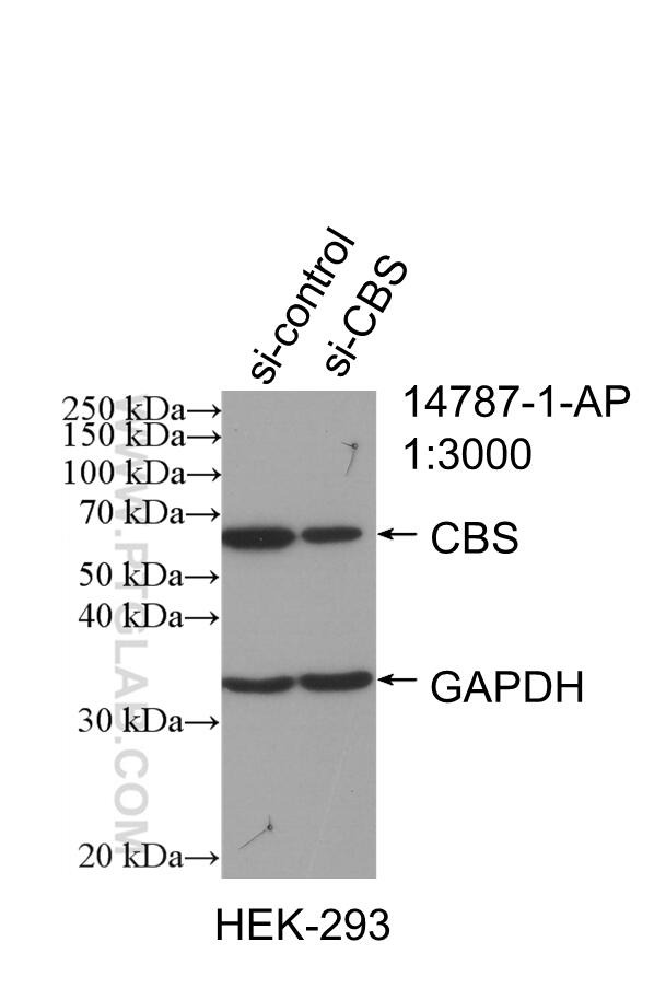 Western Blot (WB) analysis of HEK-293 cells using CBS Polyclonal antibody (14787-1-AP)