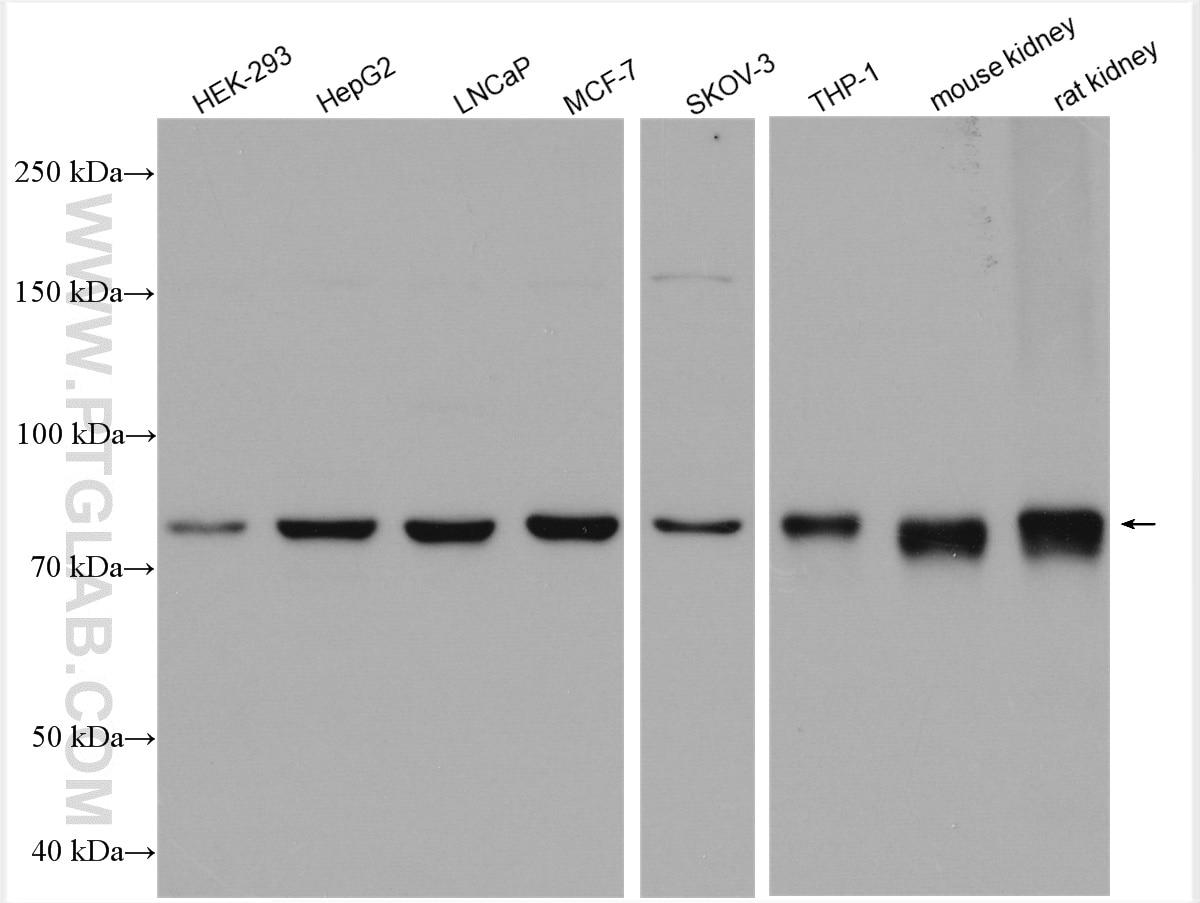 Western Blot (WB) analysis of various lysates using CBS Polyclonal antibody (14787-1-AP)
