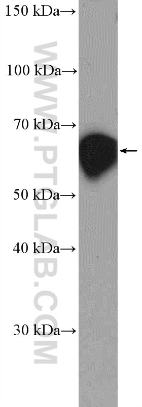 Western Blot (WB) analysis of rat kidney tissue using CBS Polyclonal antibody (14787-1-AP)