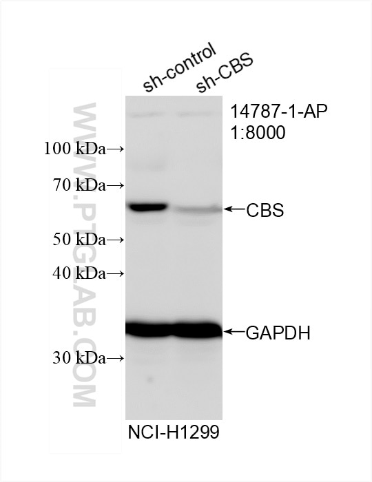 Western Blot (WB) analysis of NCI-H1299 cells using CBS Polyclonal antibody (14787-1-AP)