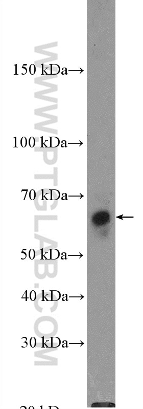 Western Blot (WB) analysis of mouse colon tissue using CBS Polyclonal antibody (14787-1-AP)