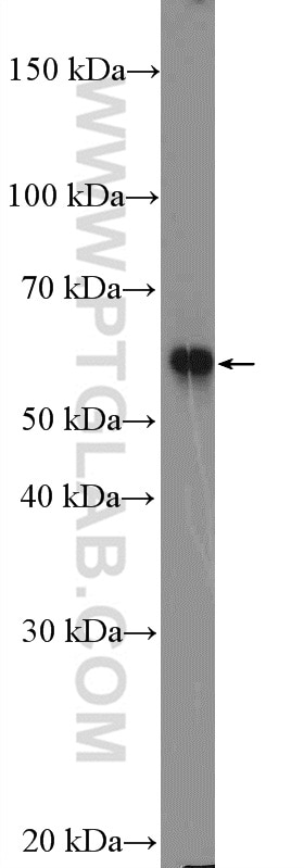 Western Blot (WB) analysis of HEK-293 cells using CBS Polyclonal antibody (14787-1-AP)