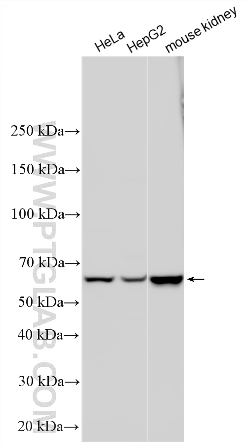 Various lysates were subjected to SDS PAGE followed by western blot with 14787-1-AP (CBS antibody) at dilution of 1:20000 incubated at room temperature for 1.5 hours. Western Blot (WB) analysis of various lysates using CBS Polyclonal antibody (14787-1-AP)