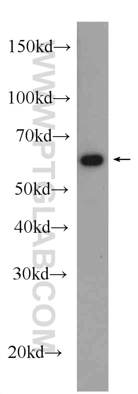Western Blot (WB) analysis of rat brain tissue using CBS Polyclonal antibody (14787-1-AP)