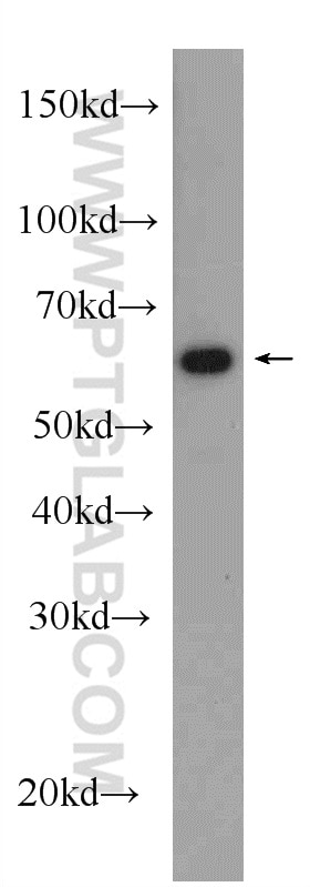 WB analysis of rat brain using 14787-1-AP