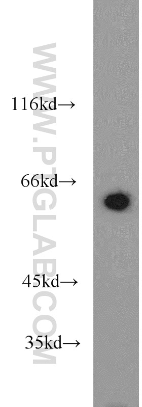 Western Blot (WB) analysis of rat liver tissue using CBS Polyclonal antibody (14787-1-AP)