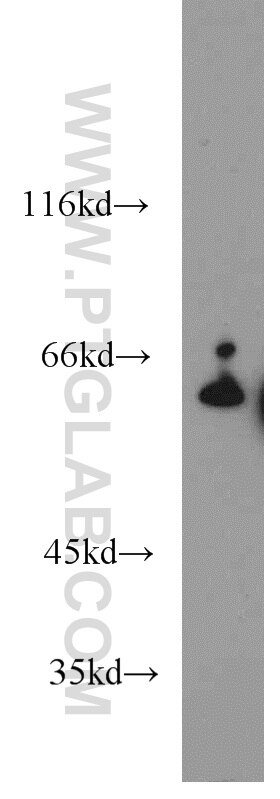 Western Blot (WB) analysis of mouse brain tissue using CBS Polyclonal antibody (14787-1-AP)