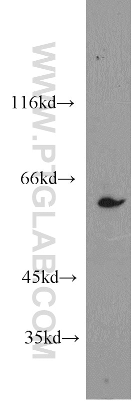 Western Blot (WB) analysis of HeLa cells using CBS Polyclonal antibody (14787-1-AP)