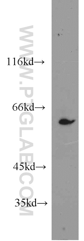 WB analysis of HeLa using 14787-1-AP