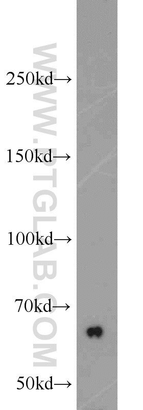 Western Blot (WB) analysis of mouse kidney tissue using CBS Polyclonal antibody (14787-1-AP)