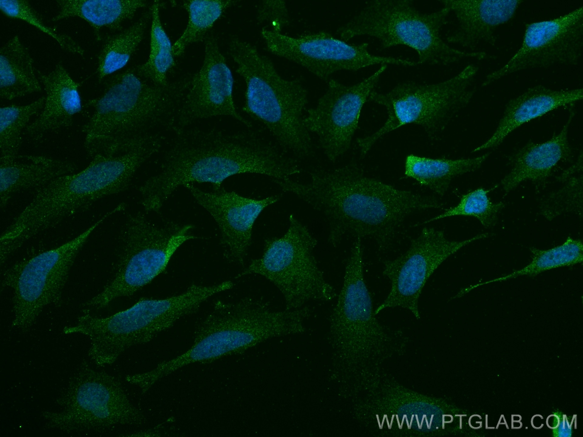 Immunofluorescence (IF) / fluorescent staining of HeLa cells using CBS Monoclonal antibody (67861-1-Ig)
