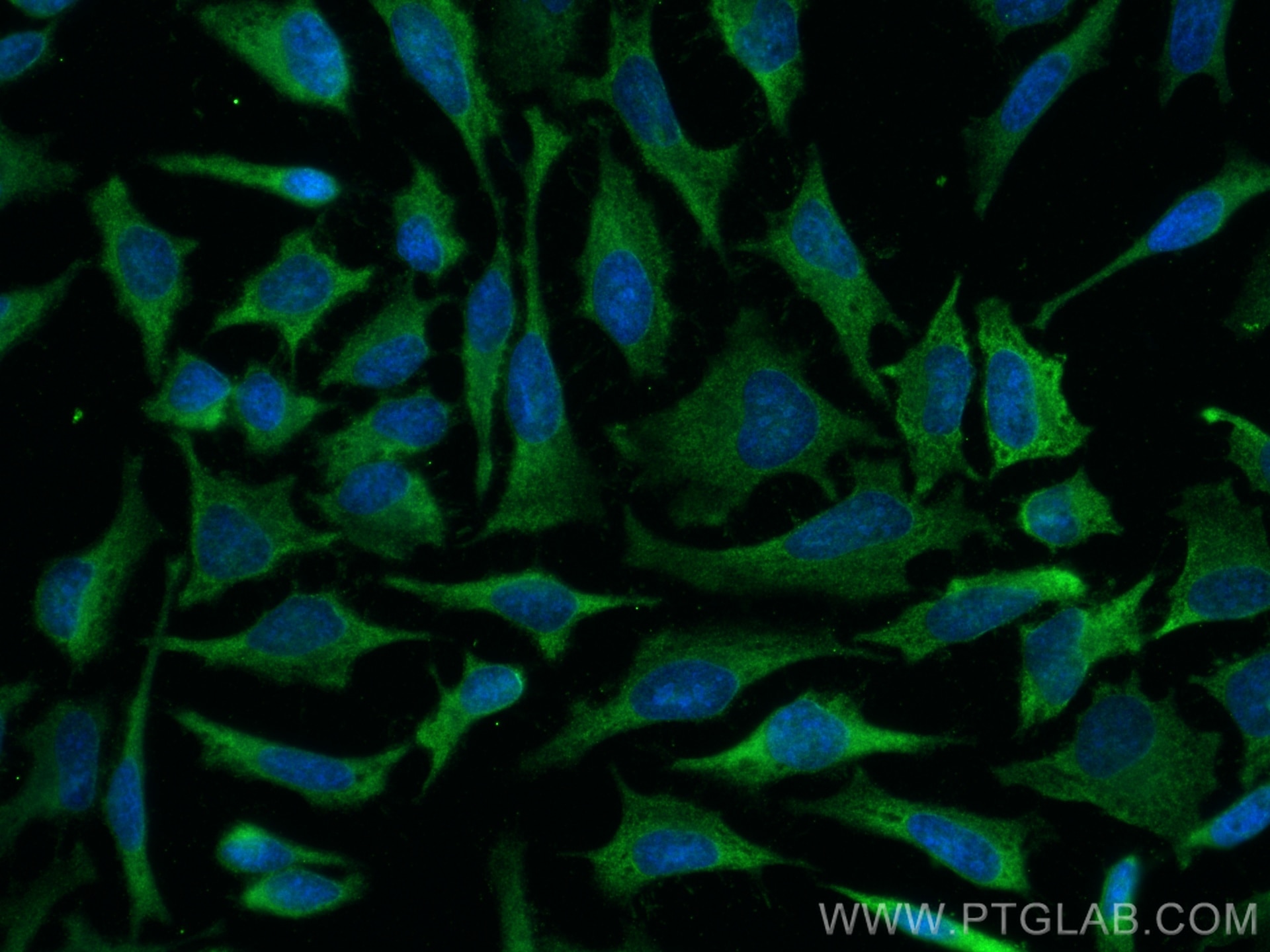 IF Staining of HeLa using 67861-1-Ig