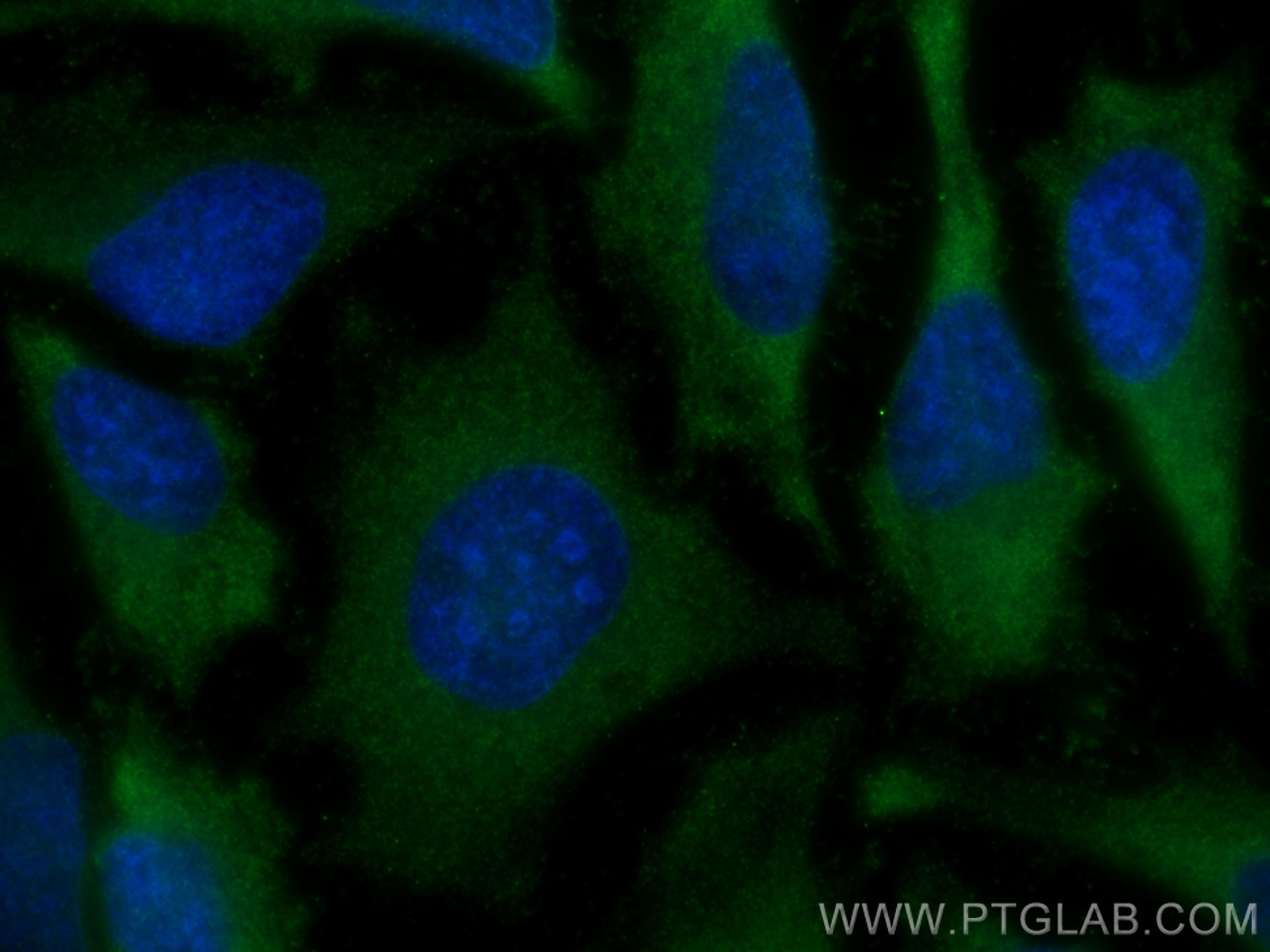 Immunofluorescence (IF) / fluorescent staining of HeLa cells using CBS Monoclonal antibody (67861-1-Ig)