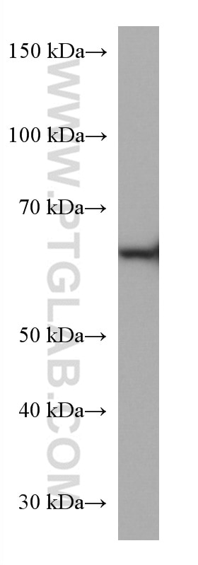 Western Blot (WB) analysis of Jurkat cells using CBS Monoclonal antibody (67861-1-Ig)