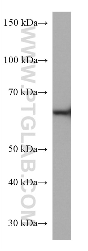 WB analysis of Jurkat using 67861-1-Ig
