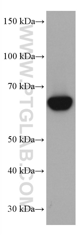 Western Blot (WB) analysis of K-562 cells using CBS Monoclonal antibody (67861-1-Ig)