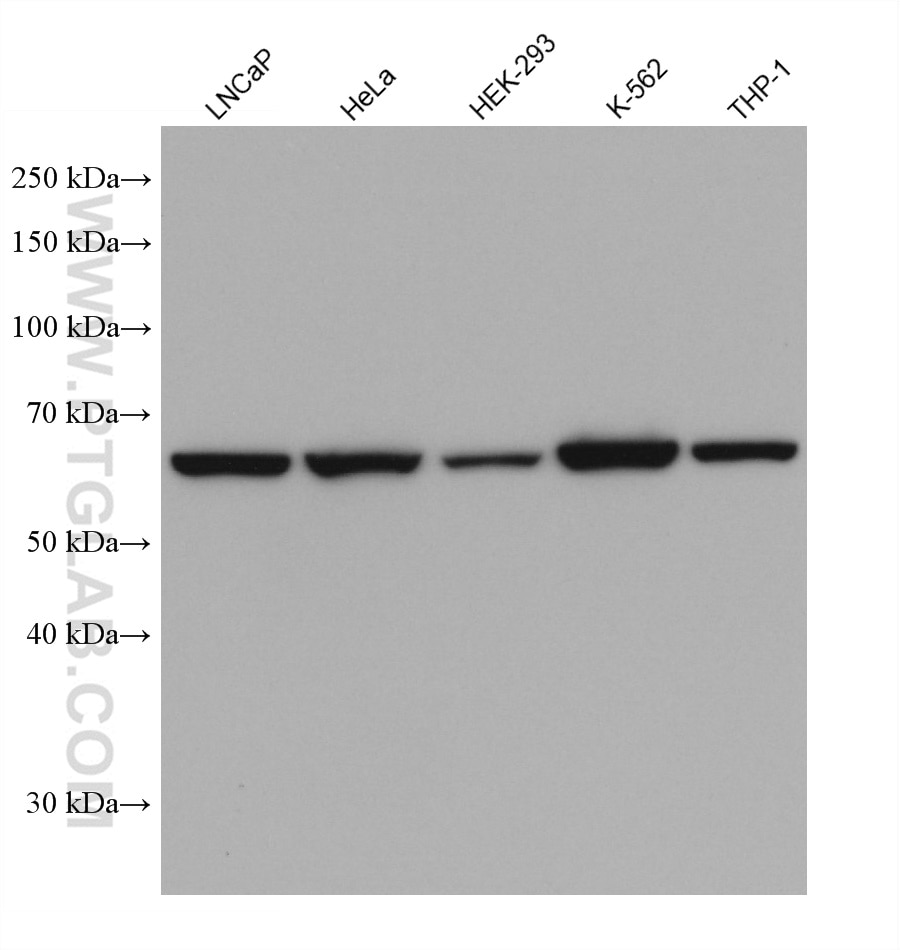 Western Blot (WB) analysis of various lysates using CBS Monoclonal antibody (67861-1-Ig)