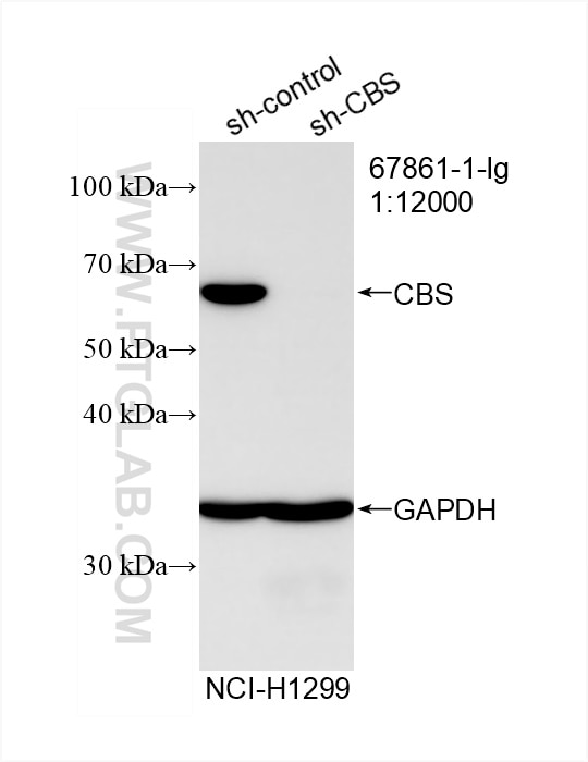Western Blot (WB) analysis of NCI-H1299 cells using CBS Monoclonal antibody (67861-1-Ig)