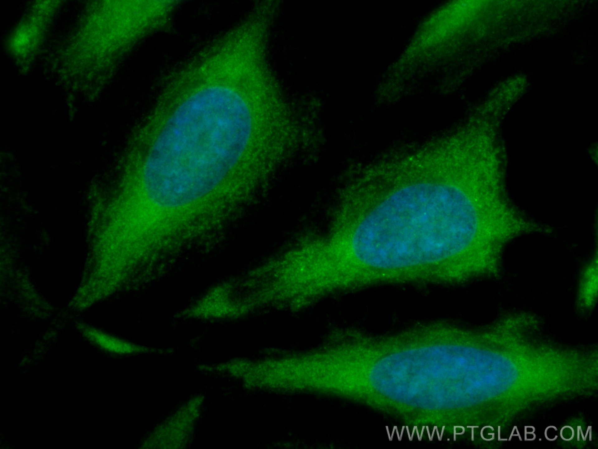 Immunofluorescence (IF) / fluorescent staining of HeLa cells using CoraLite® Plus 488-conjugated CBS Polyclonal antib (CL488-14787)
