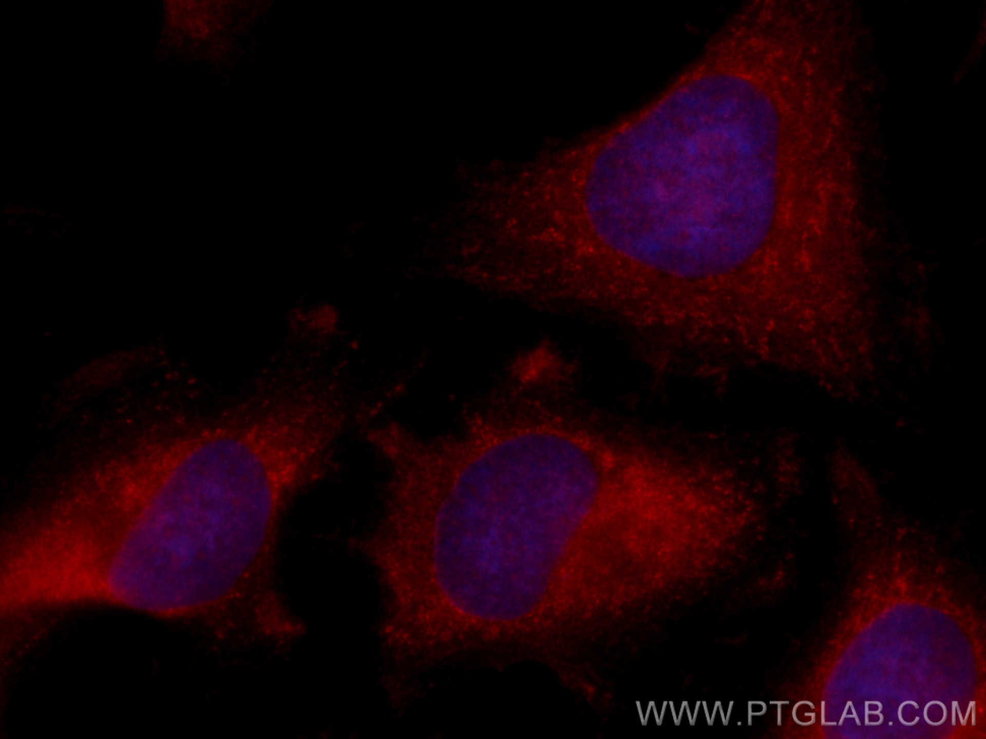 Immunofluorescence (IF) / fluorescent staining of HeLa cells using CoraLite®594-conjugated CBS Polyclonal antibody (CL594-14787)