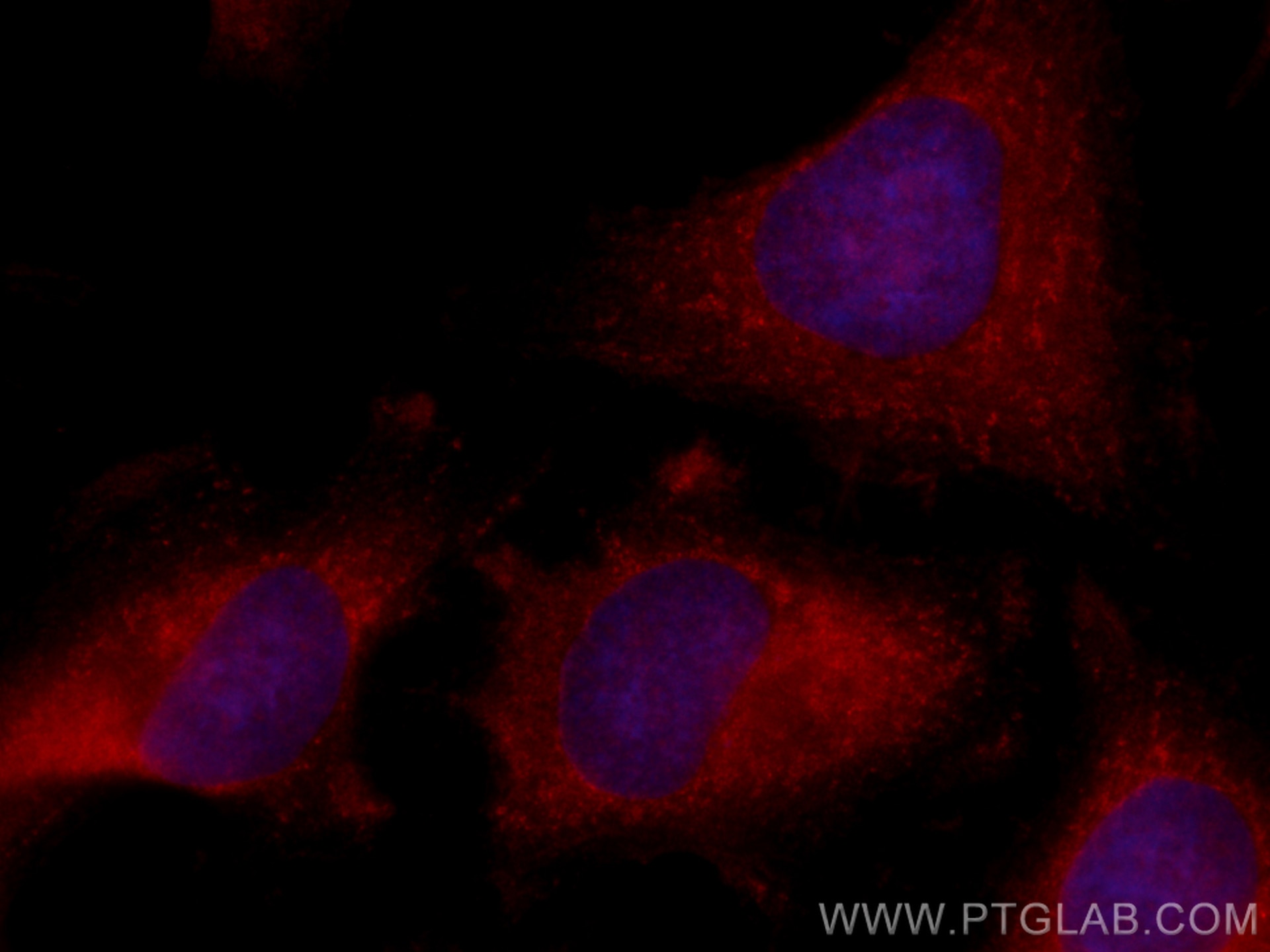 IF Staining of HeLa using CL594-14787