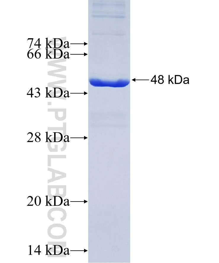 CBS fusion protein Ag7008 SDS-PAGE