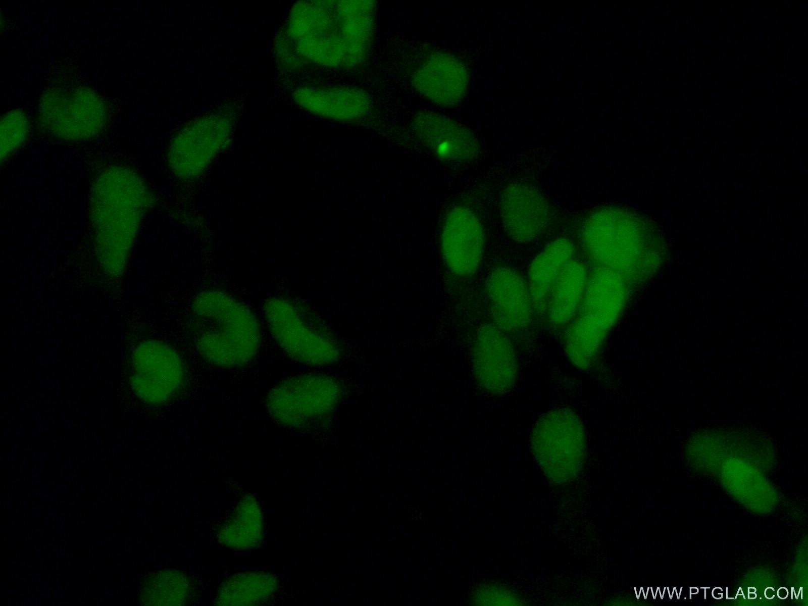 Immunofluorescence (IF) / fluorescent staining of HEK-293 cells using CBX1 Polyclonal antibody (10241-2-AP)