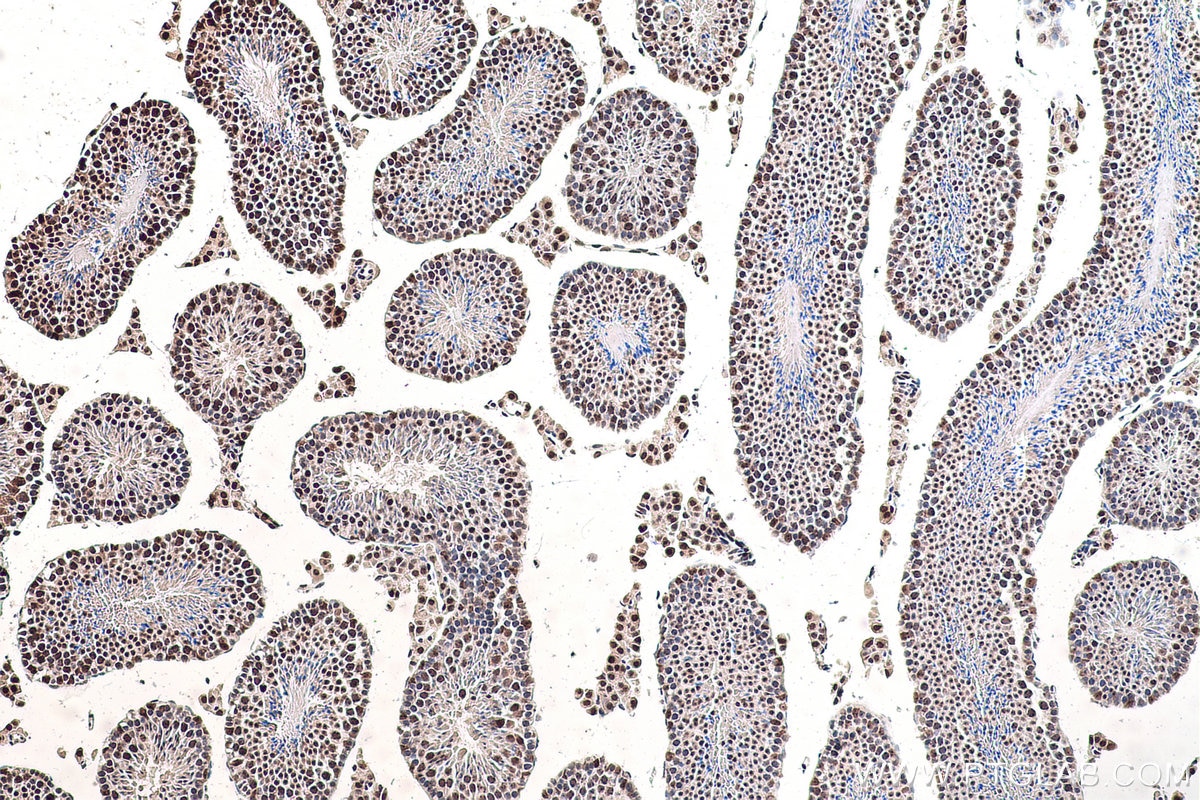 Immunohistochemistry (IHC) staining of mouse testis tissue using CBX1 Polyclonal antibody (10241-2-AP)