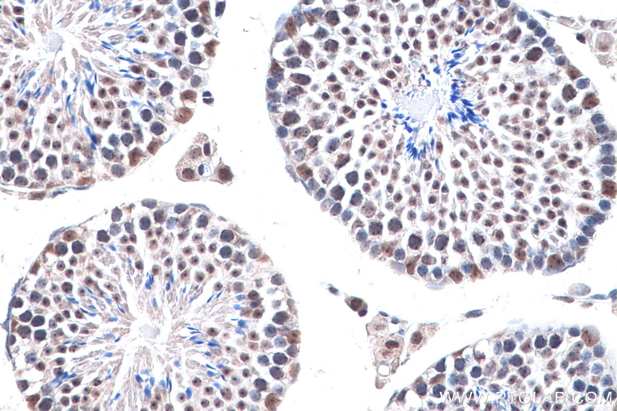 Immunohistochemistry (IHC) staining of mouse testis tissue using CBX1 Polyclonal antibody (10241-2-AP)