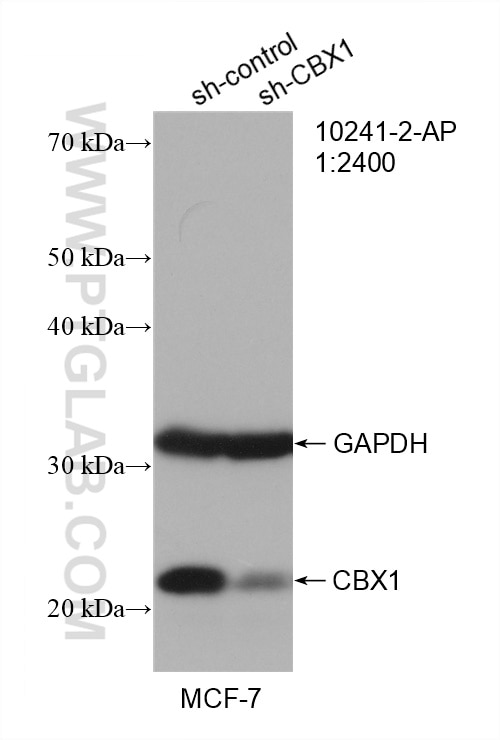 Western Blot (WB) analysis of MCF-7 cells using CBX1 Polyclonal antibody (10241-2-AP)