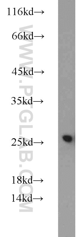 Western Blot (WB) analysis of HEK-293 cells using CBX1 Polyclonal antibody (10241-2-AP)