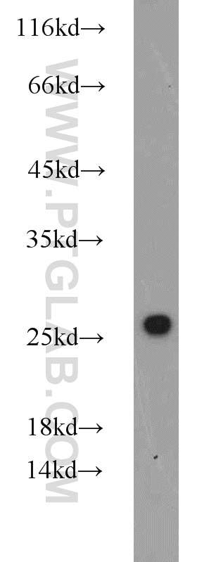 Western Blot (WB) analysis of HEK-293 cells using CBX1 Polyclonal antibody (10241-2-AP)
