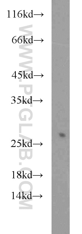 CBX1