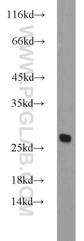 Western Blot (WB) analysis of A431 cells using CBX1 Polyclonal antibody (10241-2-AP)