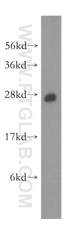 Western Blot (WB) analysis of human brain tissue using CBX1 Polyclonal antibody (10241-2-AP)