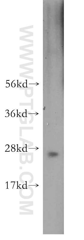 Western Blot (WB) analysis of HeLa cells using CBX1 Polyclonal antibody (10241-2-AP)
