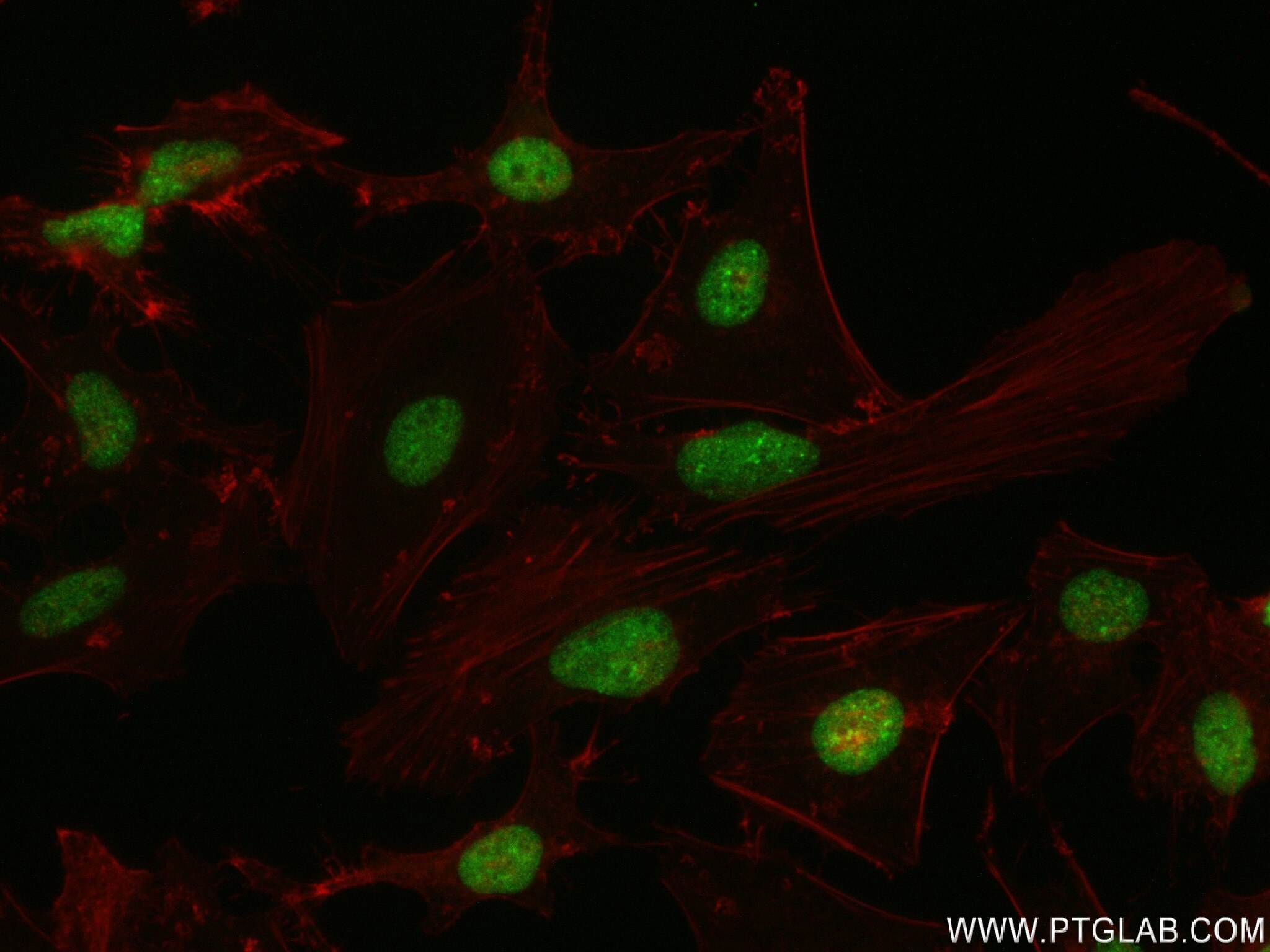 Immunofluorescence (IF) / fluorescent staining of HeLa cells using CBX1 Recombinant antibody (83248-3-RR)